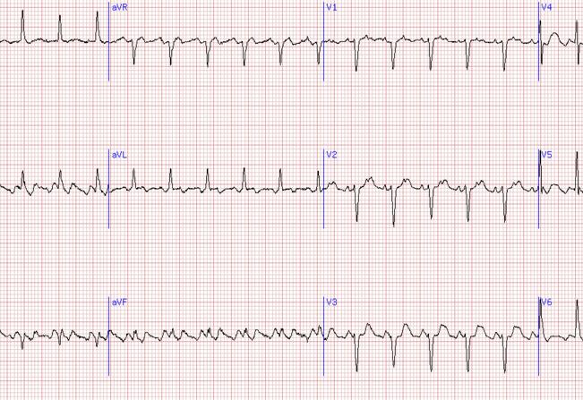 AG亚娱集团官方-新政下，建造师和消防师的挂靠是否还能吃香？